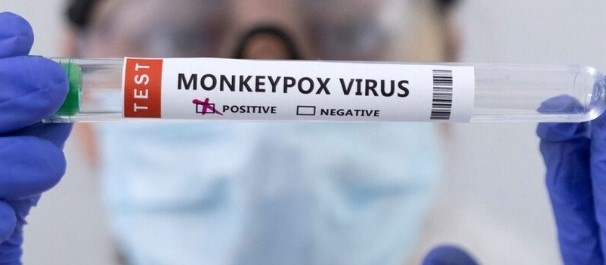 Съмнения за трети случай на маймунска шарка у нас Това